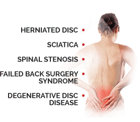 Spinal Conditions that Cause Back Pain