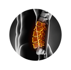 Lumbar Spine Surgery Xray