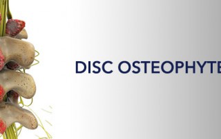 Disc Osteophyte Complex in Vertebral Column